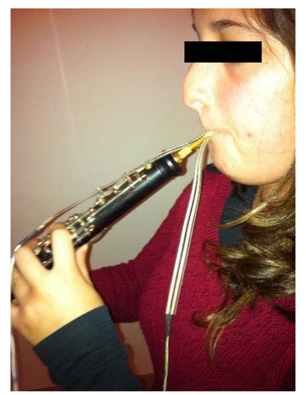 Wind Instrumentalist Embouchure and the Applied Forces on the Perioral