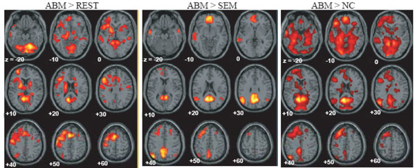 Brain Activation During Autobiographical Memory Retrieval With Special 
